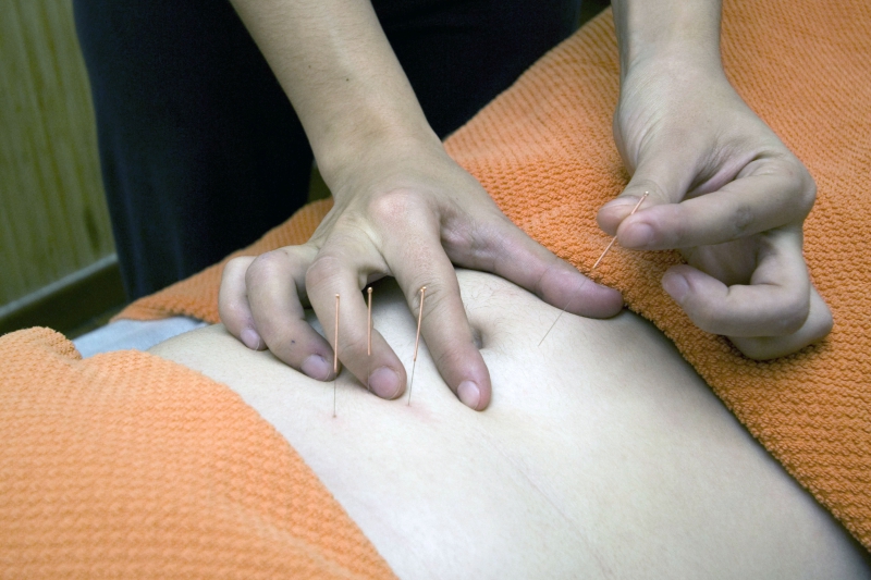 osteopathe-ILONSE-min_acupuncture-4175625